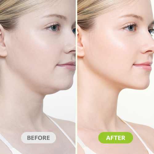 ARYNEZ® LIFTING MEWING BAND